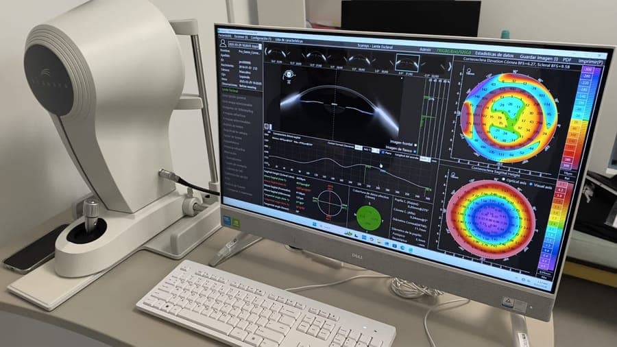 Topógrafo corneal mostrando un mapa de la córnea en la sede de Quito
